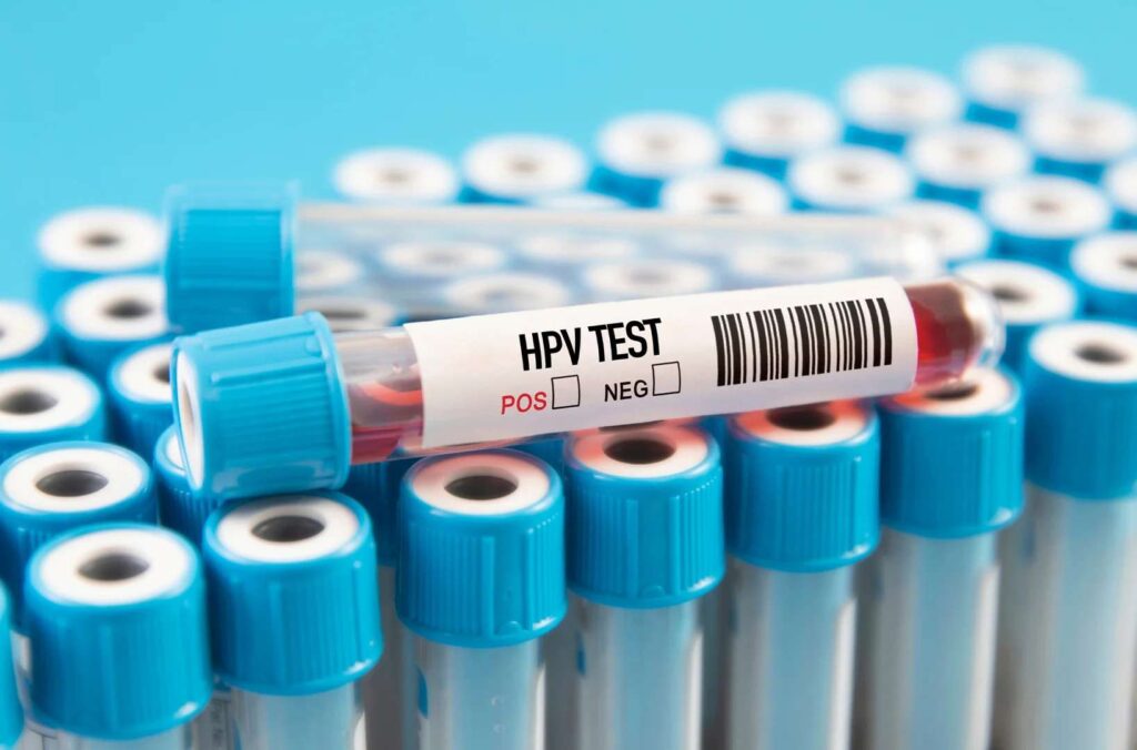 تشخیص زگیل تناسلی