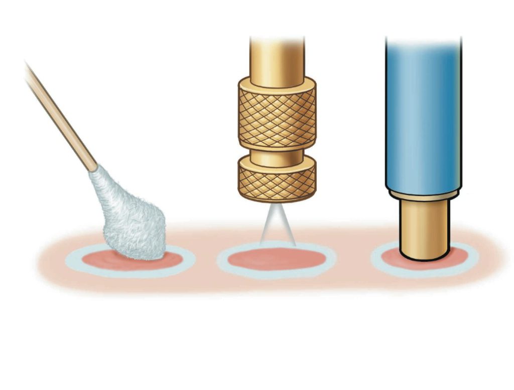 روش های درمان